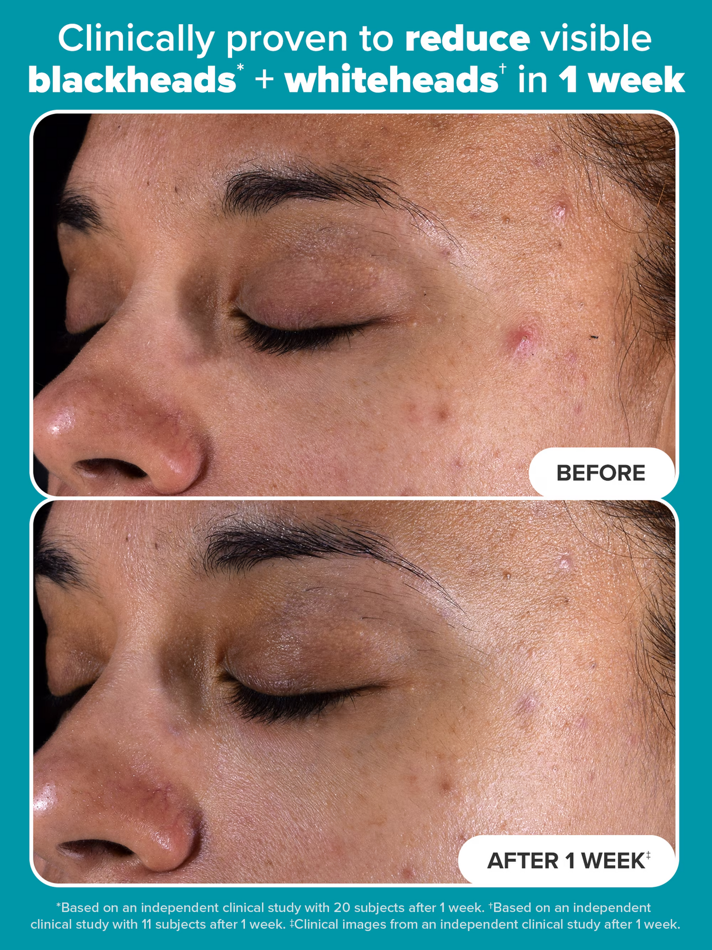 2% BHA Liquid Exfoliant