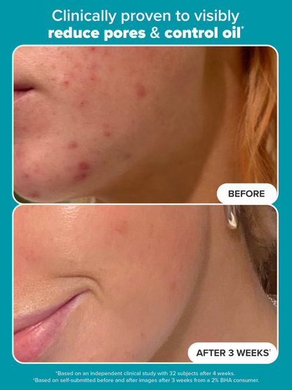 2% BHA Liquid Exfoliant